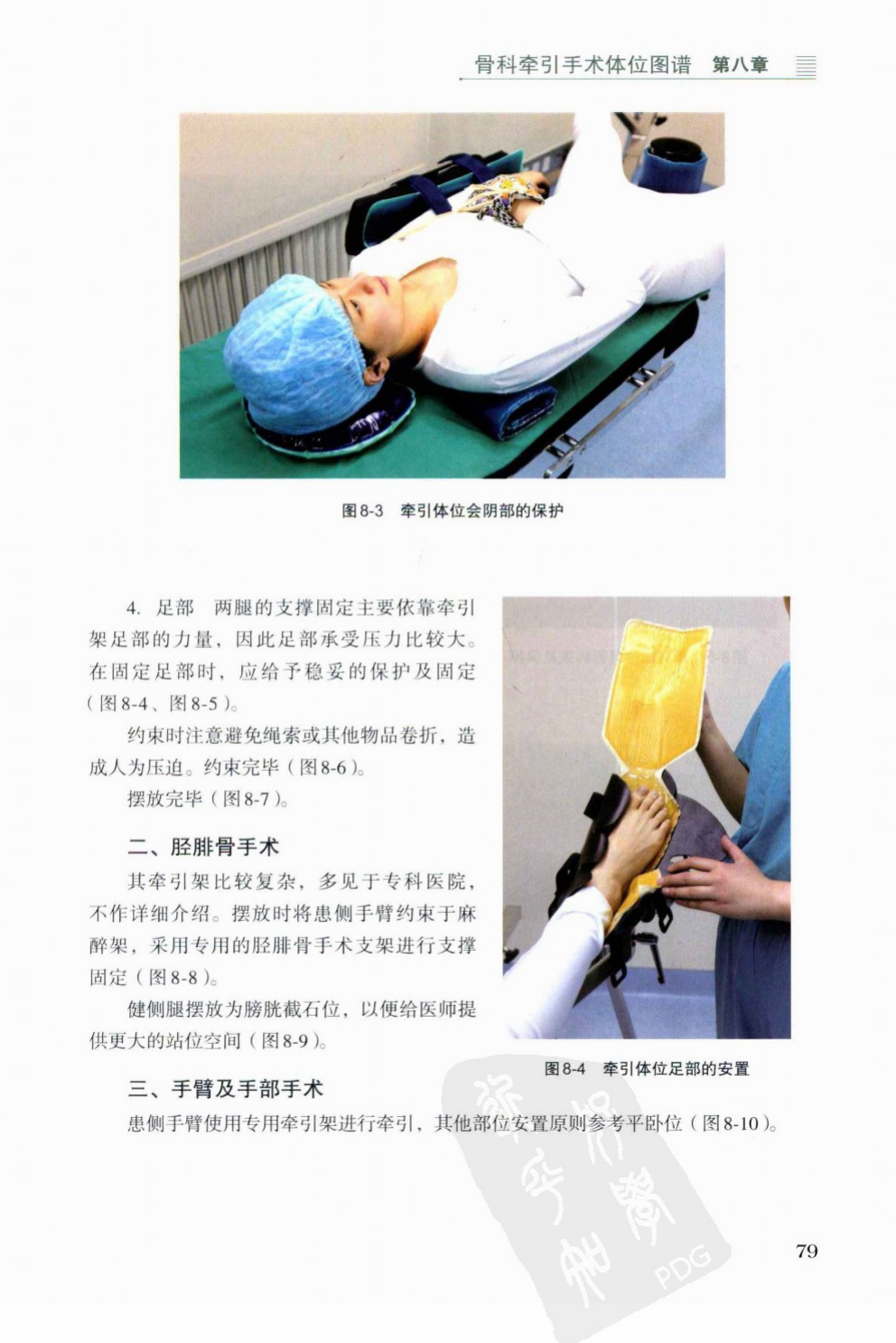 Perineal column protection and gel-padded foot-traction boot.