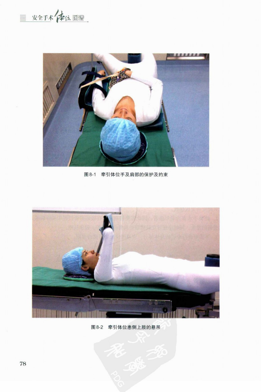 Hip-traction setup with affected-arm protection and shoulder suspension.