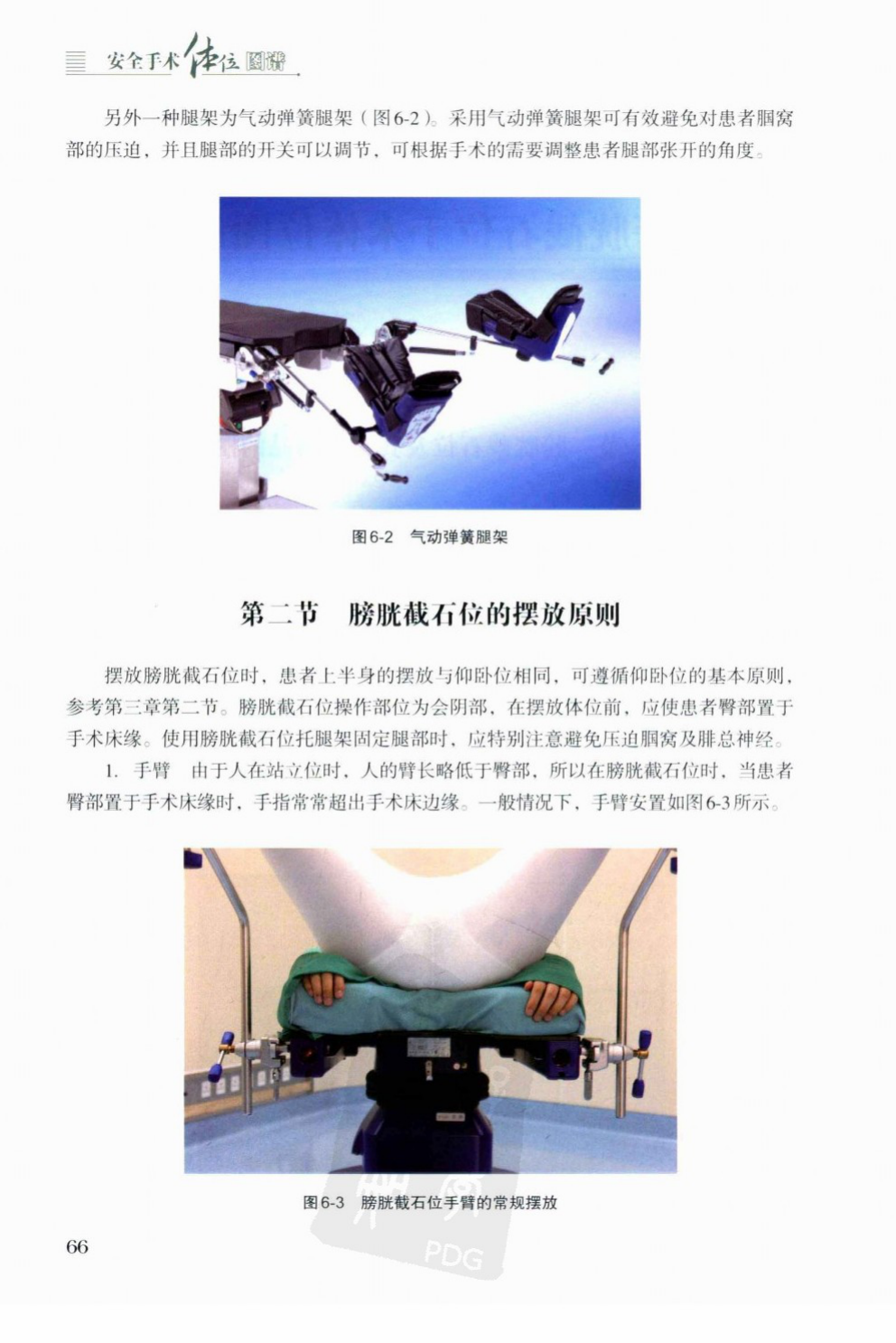Pneumatic lift-assisted stirrups and standard arm position in lithotomy.