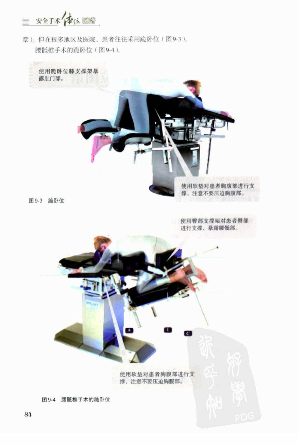 Knee-chest position for anorectal surgery and lumbosacral procedures.