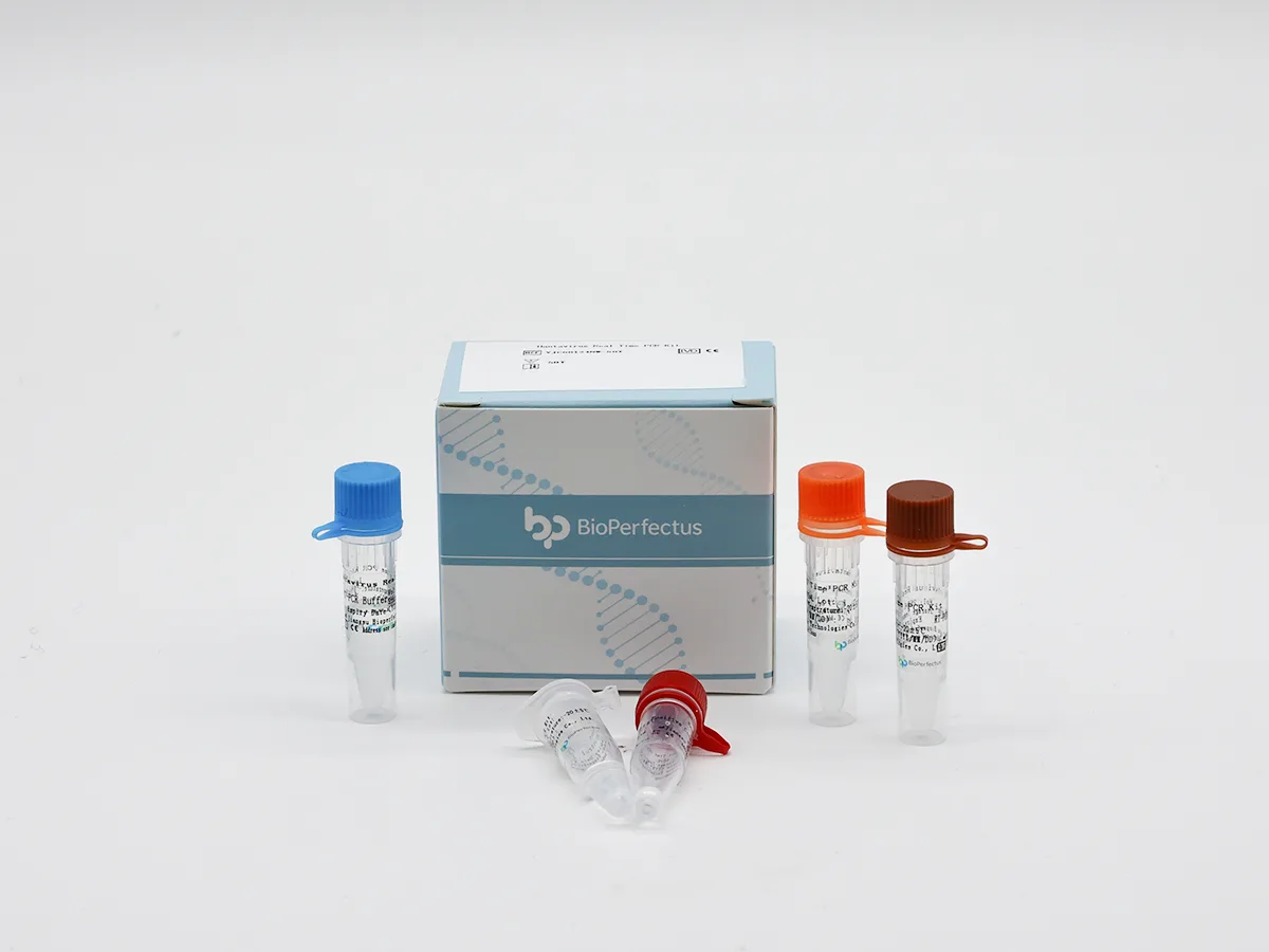 Hantavirus Real-Time PCR Kit