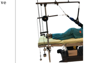 Elbow, Ankle Traction and Backplane Extension Plate — image 3