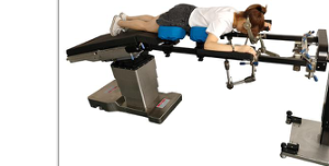 Surgical Widening Plates, Renal Bridges, Multi-Joint Arms & Powered Saline Racks — Comprehensive Operating Table Accessory System for Hepatobiliary, Urological, Arthroscopic & Suspension Procedures — image 7