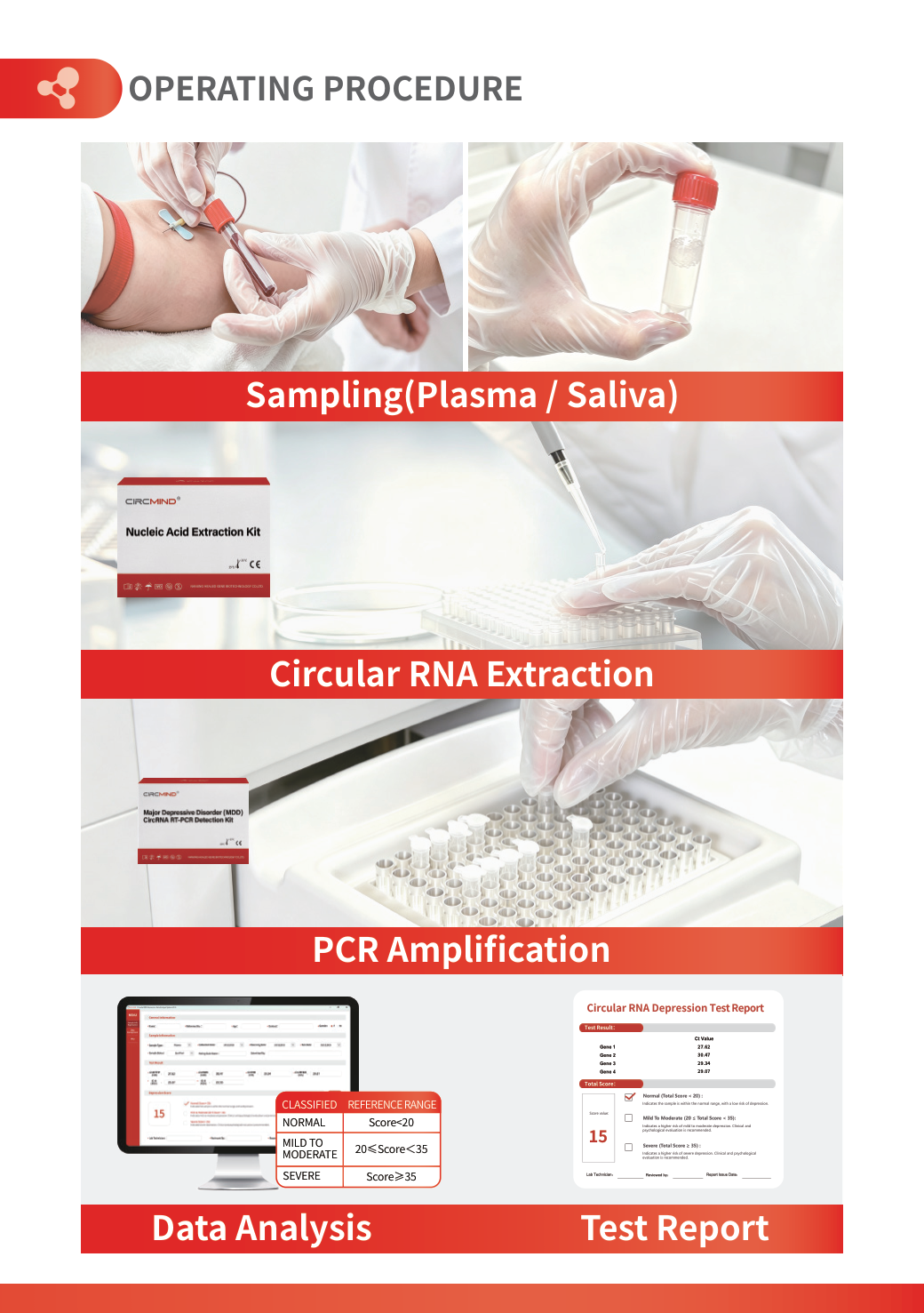 Major Depressive Disorder (MDD) CircRNA RT-PCR Detection Kit — image 4